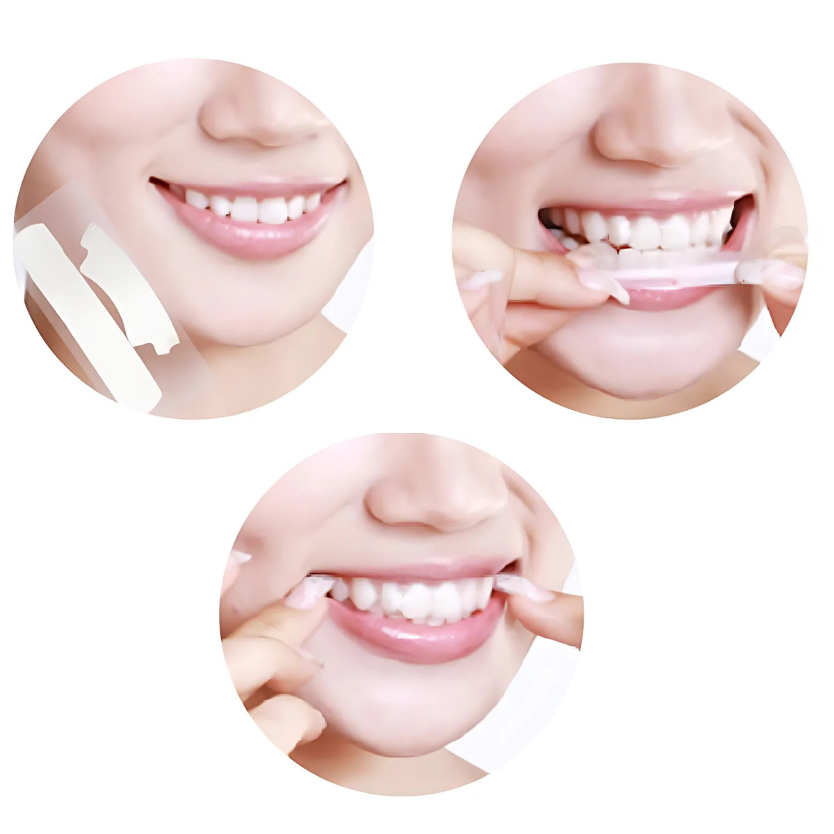 Smilumin – Kit de cuidados dentários com luz LED e tiras